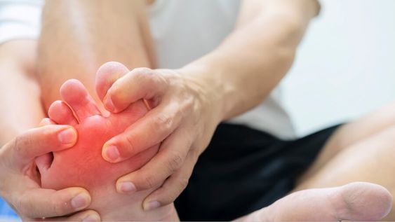 علاج النقرس طبيعياً