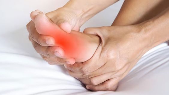 علاج النقرس طبيعياً