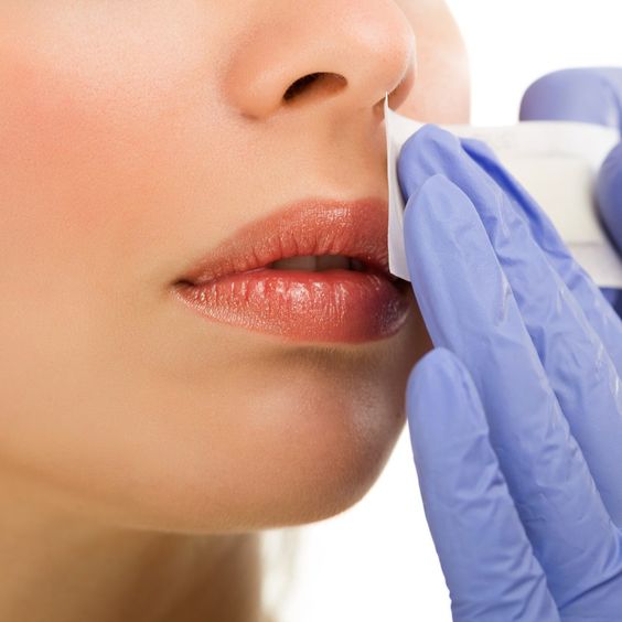 طرق لإزالة شعر الشفة العليا 