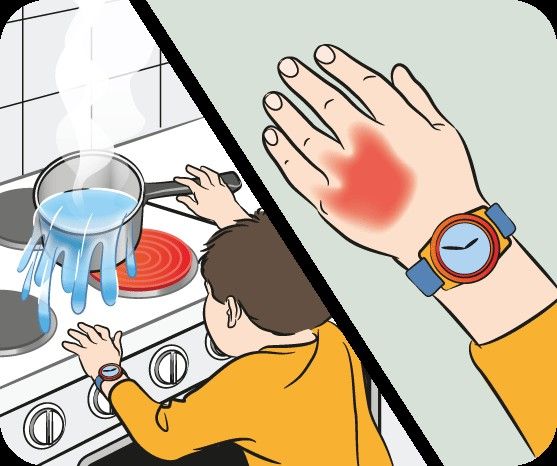 ما هي المراهم التي تستخدم للحروق؟