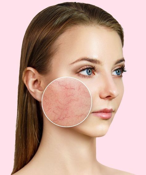 طرق عمل ماسك للبشرة الحساسة